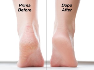Piatra exfolianta Beper C301ABE200, microcristale, pentru toate tipurile de piele - Img 5