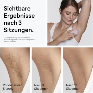 Dispozitiv IPL pentru Epilare Braun Silkexpert Mini PL1112, Roz - Img 3