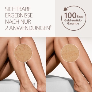 Dispozitiv IPL pentru indepartarea parului Philips Lumea 8000 BRI93400, 2 aplicatoare, utilizare acasa - Img 3