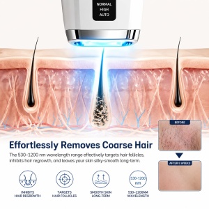 Epilator IPL Mulbijeo, 999.999 impulsuri, 21J, racire integrata - Img 3