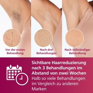 Aparat de indepartare a parului Philips Lumea IPL seria 7000 - Dispozitiv de indepartare a parului cu aparat de tuns compact satinat, 2 accesorii pentru corp si fata (model BRI921/00) - Img 3