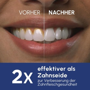 Munddusche Waterpik Ultra Professional WP-667EU, 10 trepte de presiune, 2 duze incluse - Img 3