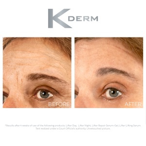 Crema antirid de zi, Lifter Day, K'DERM, 50 ml - Img 3