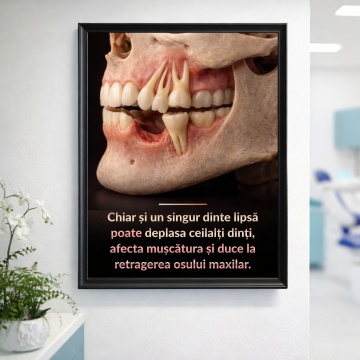 Poster cu Ramă Neagră – Un singur dinte schimbă totul DNT43