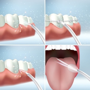 Descoperiți Irigatorul dentar portabil reîncărcabil  - fără fir, ușor, portabil, cu design rezistent la apă, trei moduri de utilizare și patru capete pentru o curățare precisă și eficientă a dinților și gingiilor. 