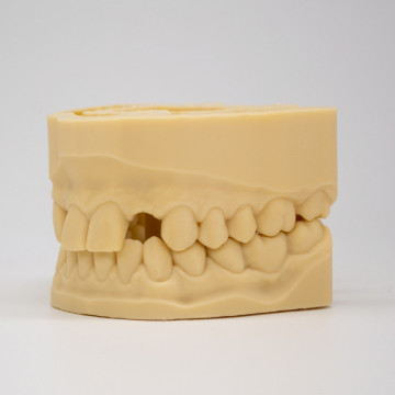 Mulaj dentar printat din rasina AmeraLabs DMD-21 Sand - Filamente3D.ro