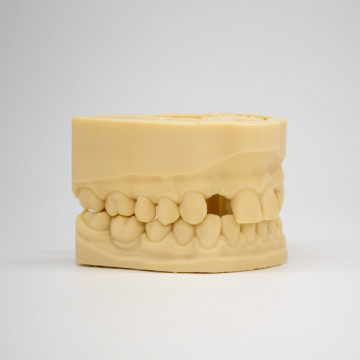 Detaliu mulaj dentar printat din rasina AmeraLabs DMD-21 Sand - Filamente3D.ro