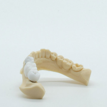 Model dentar printat din rasina AmeraLabs DMD-21 Sand 1kg - Filamente3D.ro
