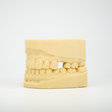 Dinti - maxilar printati din rasina AmeraLabs DMD-21 Sand - Filamente3D.ro