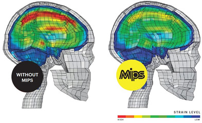MIPS