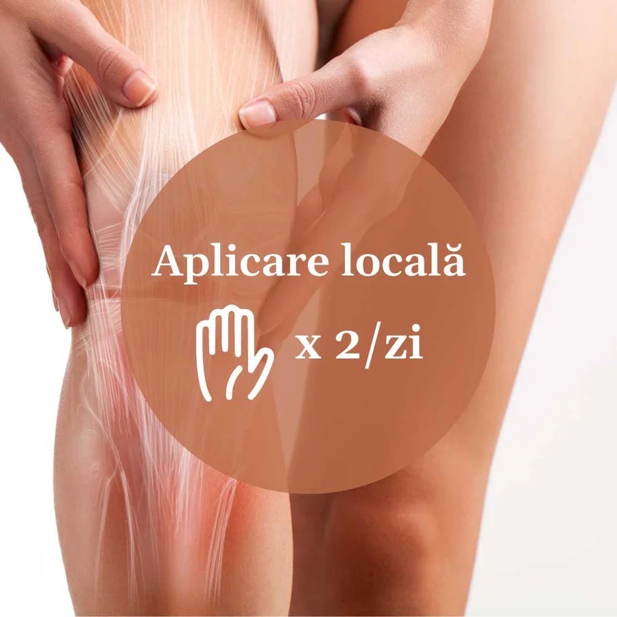 Reumaticus Forte - Gel 150ml. Formulă ultra-concentrată din plante medicinale și uleiuri esențiale pentru calmarea durerilor articulare și musculare intense - 3 | YEO