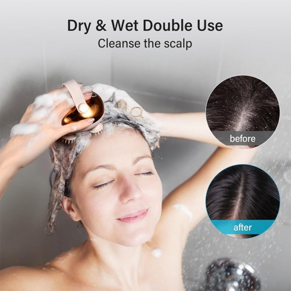 Aparat de Masaj pentru Scalp si Corp SeveShop®, Cu 4 Capete Detasabile, 3 Viteze Reglabile, Design Impermeabil, Incarcare USB Type-C, Functie Uscat/Umed, Material Silicon Alimentar, Masaj Capilar si Relaxare Corporala, Gold Metalic - Img 5
