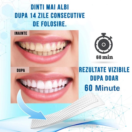 Set Benzi pentru albirea dintilor cu carbune activat, Fara peroxid, NeoSimply, 14 plicuri, 65 g - Img 5