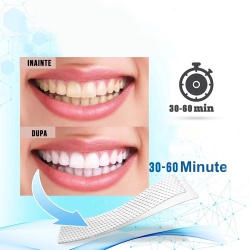 Set Benzi pentru albirea dintilor, Cu peroxid de hidrogen si ulei de cocos, NeoSimply, 14 plicuri, 28 strips 65 g - Img 4
