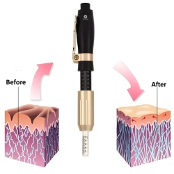 Dispozitiv tip hialuron pen NeoSimply® pentru aplicare acid hialuronic, fara ace, lifting facial, anti aging, marire buze cu 5 ampoule incluse, Gold - Img 4