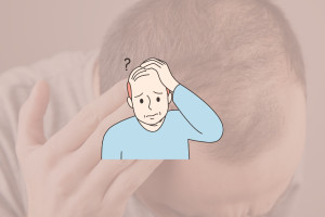 Căderea ereditară a părului (alopecia androgenetica)