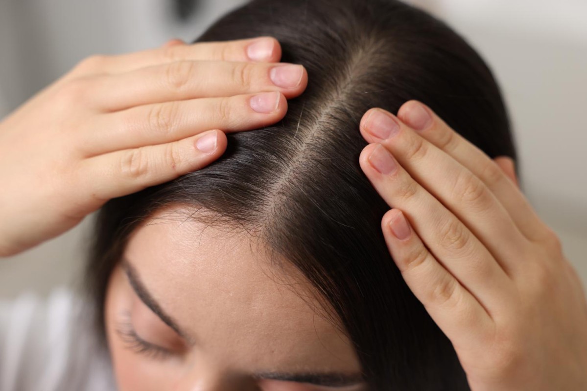 Scalp sensibil – de la cauze și simptome la metode eficiente de gestionare a problemei