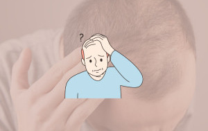 Căderea ereditară a părului (alopecia androgenetica)