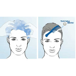 aplicare Thymuskin