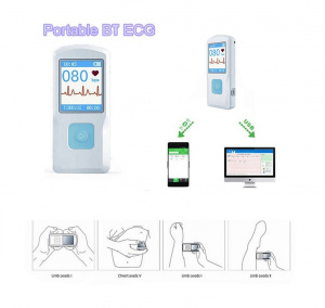 CONTEC PM10- Electrocardiograf ECG portabil, cu acumulator, conectare USB si BT - Img 4