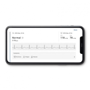 OMRON COMPLETE (HEM-7530T-E3) - Tensiometru ECG, Bluetooth, Tensiune Arteriala - Img 4