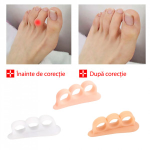 Dispozitiv Separator si Corectie pentru 3 Degete Picioare Unisex Set 2 Bucati
