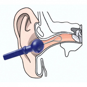 Dispozitiv pentru curatarea urechilor, Dispozitiv curatare urechi, Sistem de curatat urechile, Curatare urechi sigura, Dispozitiv curatare cerumen, Dispozitiv de igiena urechi, Curatare urechi non-invaziv, Curatator ureche reutilizabil, Dispozitiv sigur c