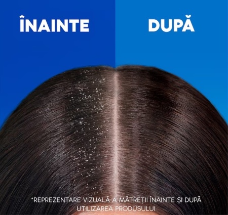 Sampon anti-matreata Head &amp; Shoulders Menthol Fresh pentru orice tip de par, 800 ml - Img 7