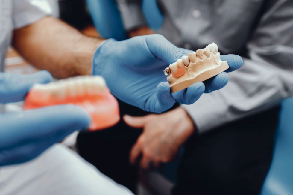 Printarea 3D în tehnică dentară
