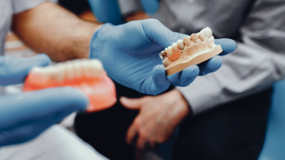 Printarea 3D în tehnică dentară
