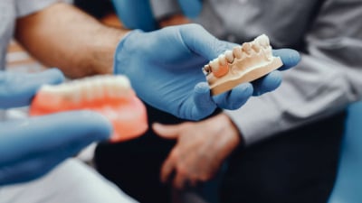 Printarea 3D în tehnică dentară