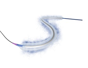 LUMIFOLLOW Registry Confirms Sustained 3-Year Performance of Luminor in Real-World Femoropopliteal Disease