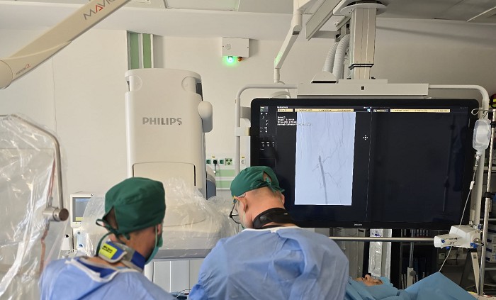Premieră medicală la Cluj-Napoca: Primul stent intracerebral implantat cu succes la un pacient cu stenoză severă a arterei bazilare