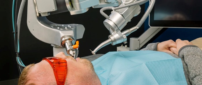 Prima procedură dentară complet automatizată pe un pacient uman| Știri digital și tech