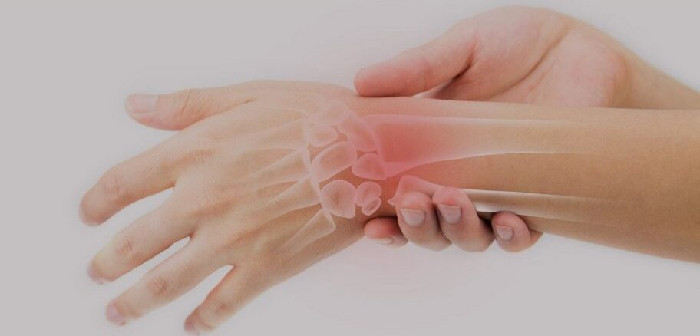 Fractură De Epifiză Distală De Radius, recomandări, tratament chirurgical și recuperare