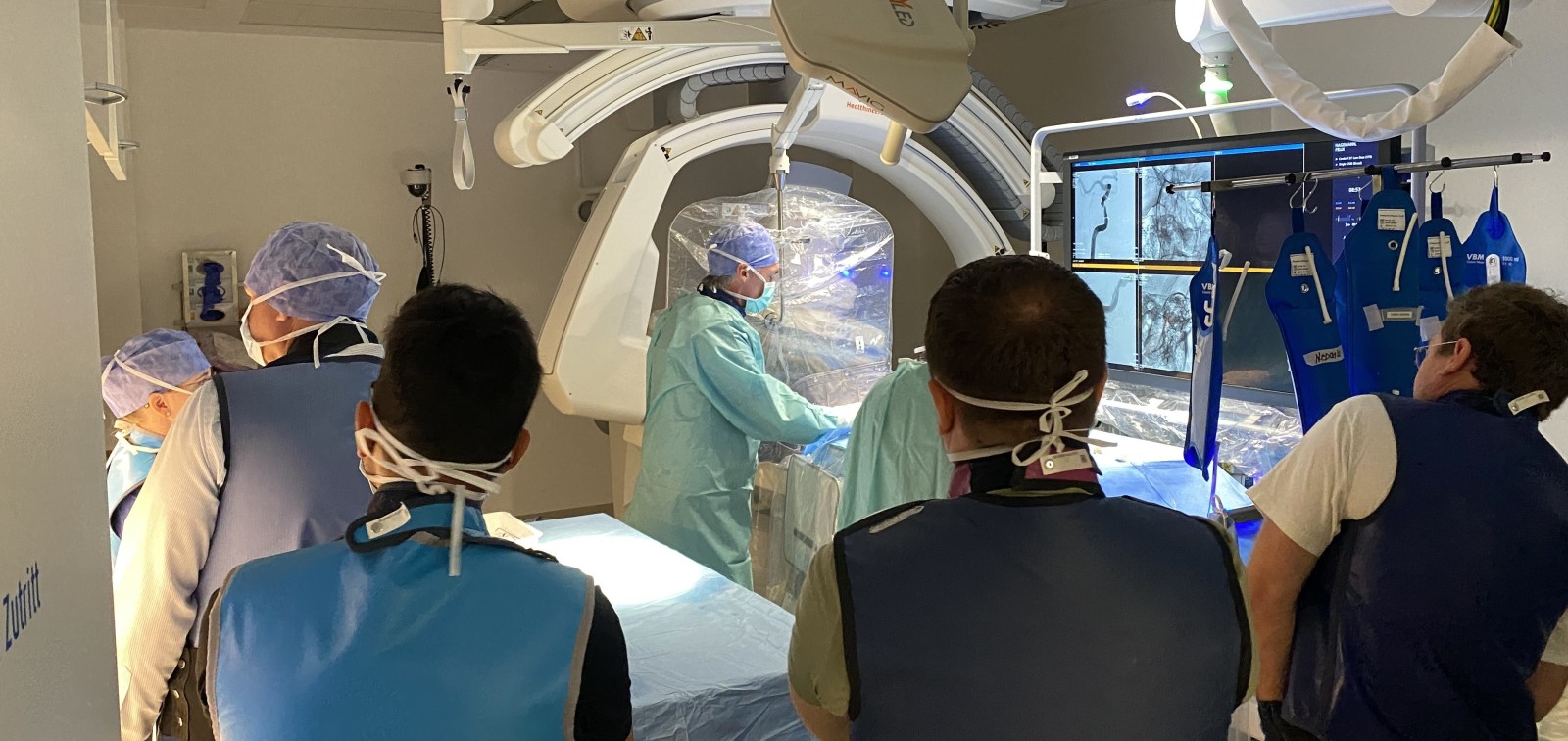 Tratamentul endovascular al ICAS (Stenoza Aterosclerotică Intracraniană)