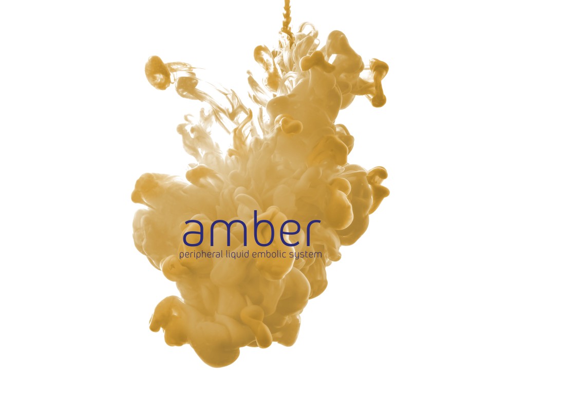 iVascular presents Phase II results of the OPAL study for Amber embolic liquid