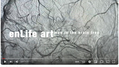 Stroke interpreted through the painting „The Man from the Brain Tree”