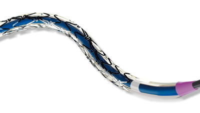 BARISTA Trial Demonstrates Excellent 1-Year Outcomes with Restorer in the Treatment of Iliac Artery Lesions