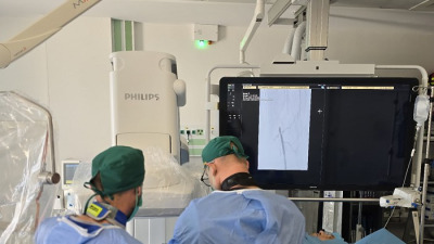 Premieră medicală la Cluj-Napoca: Primul stent intracerebral implantat cu succes la un pacient cu stenoză severă a arterei bazilare