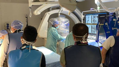 Tratamentul endovascular al ICAS (Stenoza Aterosclerotică Intracraniană)