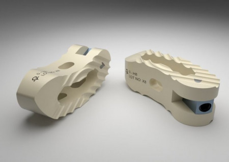 FIDES – Cage PEEK TLIF cu Fixare Anatomică pentru Chirurgia Lombară