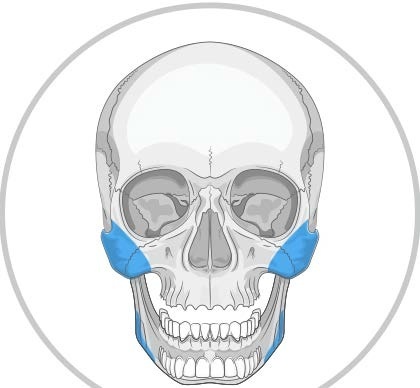 Implanturi Personalizate pentru Augmentarea Feței și Craniului | Chirurgie Plastică și Estetică - Img 5