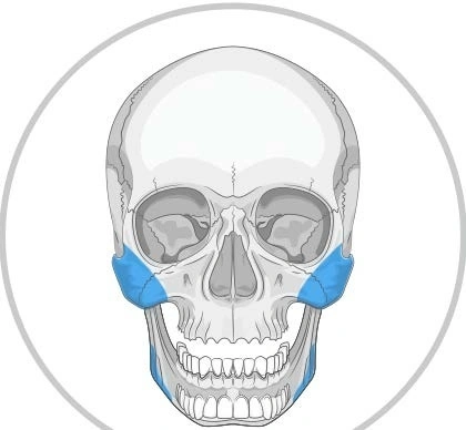 Implanturi Personalizate pentru Augmentarea Feței și Craniului | Chirurgie Plastică și Estetică, MEDPRIN - Img 5