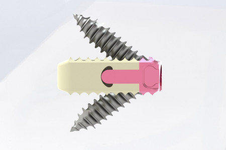 TITANOPEEK - Cage Vertebral Cervical cu suruburi de prindere si profil anatomic