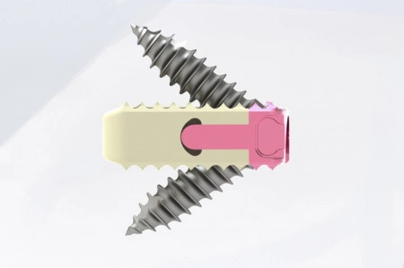 TITANOPEEK - Cage Vertebral Cervical cu suruburi de prindere si profil anatomic