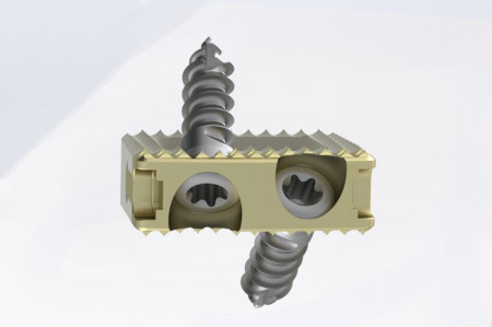 TITANOPEEK - Cage Vertebral Cervical cu suruburi de prindere si profil anatomic