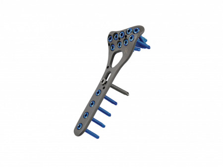 Placă Radius Distal – Fixare Volară Anatomică Poliaxială | Sistem Vortex