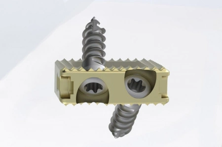 TITANOPEEK - Cage Vertebral Cervical cu suruburi de prindere si profil anatomic