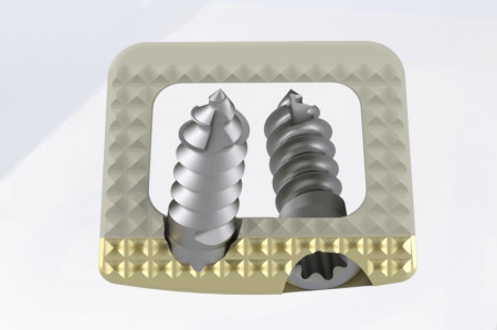 TITANOPEEK - Cage Vertebral Cervical cu suruburi de prindere si profil anatomic